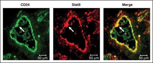 This panel adapted from Mascarenhas et al depicts the expression of total Stat5, which is activated by Jak2 signaling, within the CD34-expressing endothelium and an intra-aortic cluster of the E11.5 AGM (arrows). The first HSCs are thought to emerge within these clusters. Professional illustration by Patrick Lane, ScEYEnce Studios.