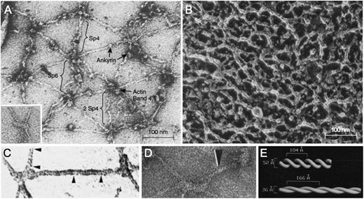 Figure 5. Negatively stained electron micrographs of red cell membrane skeletons and spectrin. (A) A membrane skeleton that was stretched during preparation. Note the pseudohexagonal organization of the skeleton and the location of various proteins. Inset: example of a 37-nm long F-actin protofilament. Sp4, spectrin tetramer; Sp6, spectrin hexamer; 2 Sp4, double spectrin tetramers. (B) Skeleton in situ in a red cell prepared by a minimally perturbing quick-freeze, deep-etch, rotary replication procedure. The dense network of filaments averages 29 ± 9 nm between intersections. (C-D) Spectrin from partially stretched skeletons. Some of the spectrin molecules show a helical periodic substructure, as noted by the region between the arrowheads in panel C or by the single arrowhead in panel D. (E) Right-handed double-helical models of spectrin periodicity obtained from the experiments in panel D by visual filtering of the periodic regions from multiple spectrin molecules. In this model, the springlike spectrins extend and contract by varying their pitch and diameter. Native spectrin tetramer has ∼10 turns, with a pitch of ∼7 nm (70 Å) and a diameter of ∼5.9 nm (59 Å). Panel A reprinted from Liu et al27; panel A inset from Byers and Branton65; panel B from Ursitti et al66; panel C from Ursitti and Wade30; and panels D and E from McGough and Josephs,28 all with permission.