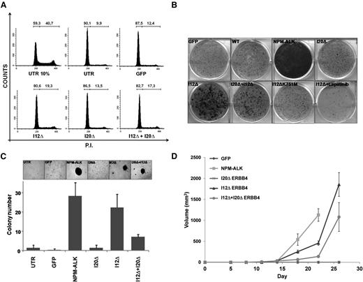 Figure 5. ERBB4-truncated forms show oncogenic potentials in NIH-3T3 cells. (A) NIH-3T3 cells transduced with the indicated constructs were analyzed for cell cycle after serum deprivation (72 hours). I12Δ- and I20Δ+I12Δ-transduced cells displayed reduced G0/G1 arrest compared to controls. (B) Focus formation assay of NIH-3T3 cells transduced with the indicated constructs. I12ΔERBB4 transformation potential is kinase dependent as suggested by ERBB4 kinase dead construct (I12ΔK751M) expression and lapatinib treatment. (C) Soft agar assay of NIH-3T3 cells transduced with the indicated constructs. Increased numbers of colonies were detected in I12Δ-, I20Δ+I12Δ-, and NPM-ALK–transduced cells. (D) Tumor growth curves of NIH3T3 cells transduced with the indicated constructs. A total of 5 × 104 cells were subcutaneously injected into 6 NSG mice for each condition. Tumor growth was monitored over time by determining the volume of tumor masses. Each data point represents the average tumor volume (mean ± standard error). P.I., propidium iodide.