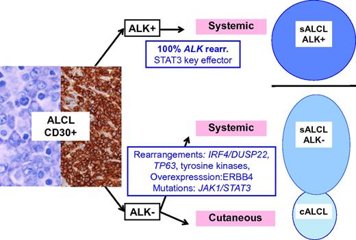 Schematic representation of ALCL entities and their genetic-associated aberrations. ALK-positive ALCL is a well-delineated entity, primarily defined by ALK translocations. Other lymphomas with similar anaplastic morphology and CD30 expression do occur, either as a systemic disease, referred as ALK-negative ALCL, a provisional entity in the current classification, or as a primary cutaneous neoplasm, primary cutaneous ALCL, which are part of the spectrum of primary cutaneous CD30+ lymphoproliferative disorders and usually pursue a benign course. sALCL, systemic ALCL; rear., rearrangement.