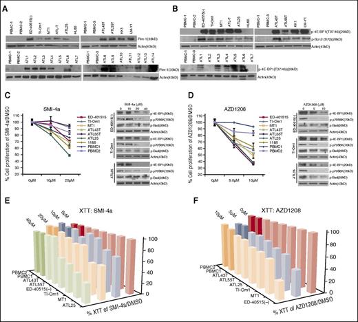 Figure 6. Pharmacological Pim kinase inhibitors inhibit ATL cell proliferation. (A) Pim1 is overexpressed in ATL-derived cell lines and primary ATL patient samples. Normal PBMCs (n = 3) and HL60, an AML line that does not express Pim1, were used as controls. Primary acute/lymphoma ATL patient samples (n = 14) were used. (B) Overexpression of Pim1 target genes, p-4EBP1 (Thr37/46), and p-Bcl2 (Ser70) in ATL-derived cell lines and ATL patient samples (n = 7). (C-D) Loss of proliferation in ATL-derived cell lines by the Pim-kinase inhibitors, Smi-4a (C), and AZD1208 (D). Cell counts were repeated at least twice. Results represent the percentage of cells alive after 5 days of Pim inhibitor treatment, compared with 5 days treated with DMSO. For Smi-4a treatment, cells were treated with 0, 10, or 20 μM Smi-4a, and for AZD1208, cells were treated with 0, 5, or 10 μM AZD1208. Normal PBMCs (n = 2) were used as a control. Western blots indicate loss of Pim1 targets, p-4EBP1 (Thr37/46), p-p70S6K (Thr389), and loss of pBad (Ser20) (negligible for Smi-4a) after 24 hours with 0, 10, 20, or 40 μM Smi-4a; 0, 5, or 10 μM AZD1208; or DMSO control. (E-F). Loss of cell viability in ATL-derived cell lines treated with the Pim-kinase inhibitors, Smi-4a (E) and AZD1208 (F). XTT cellular metabolic assays were performed on ATL lines treated with Pim inhibitors. Results represent the percentage of XTT-positive cells after 5 days of Pim inhibitor treatment, compared with 5 days treated with DMSO. Bars represent the average of at least 2 independent experiments.