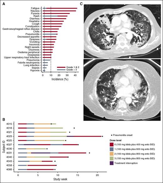 Figure 1. Treatment-emergent AEs (N = 66). (A) Serious treatment-emergent AEs included pyrexia, diarrhea, pneumonitis, dyspnea, pneumonia, febrile neutropenia, lung infection, sepsis, and hypoxia. Grade ≥3 events included fatigue, rash, diarrhea, pneumonitis, dyspnea, pneumonia, febrile neutropenia, lung infection, sepsis, and hypoxia. Time to onset of pneumonitis in each patient. (B) The onset of pneumonitis occurred after study day 50 in each patient. In 9 of the 12 patients, pneumonitis onset occurred between days 50 and 100. In 3 of the 12 patients, onset occurred between days 100 and 150. There was no relationship between dose level and pneumonitis onset. Computed tomography images of severe pneumonitis. (C) Representative computed tomography images from 2 patients who developed severe pneumonitis. Diffuse ground-glass opacities and interstitial infiltrates are demonstrated.