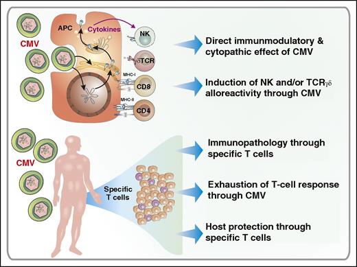 Potential mechanisms relating infection and GVL effects. GVL activity prevents hematologic malignant disease relapse following allogeneic SCT. In this regard, mechanisms for how viral infections like CMV might actually interact with leukemia relapse remain unknown, but numerous effects of CMV on the human immune system have been described. CMV is a lytic infection and has a direct cytopathic effect. CMV has immunosuppressive effects by itself, demonstrated by an increase of other infections associated with CMV reactivation. CMV is a potent activator of the first-line defense and may induce expansion in mature natural killer (NK) cells and γδT cells cross-reactive to CMV and leukemia cells. In humans, CMV persists in antigen-presenting cells (APCs) and could therefore take over the control of the adaptive immune response. Because pp65 as the most immune-dominant antigen can induce strong T-cell responses, efficient host protection as well as immunopathology may be due to the adaptive T-cell response against CMV. However, due to the strong and persistent T-cell stimulation, T-cell exhaustion and senescence may be an issue, especially in the elderly patient. MHC, major histocompatibility complex; TCR, T-cell receptor.