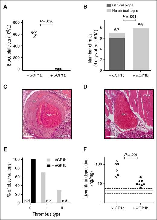 Figure 1. Depletion of platelets prevents thrombotic coagulopathy after siRNA-mediated hepatic knockdown of Serpinc1 and Proc. (A) Blood platelet numbers in mice from a parallel group not receiving siRNA 3 days after injection with saline (open circles) or with a rat monoclonal antibody targeting mouse GP1b (solid circles) (Mann-Whitney rank sum test P = .036). (B) Scoring of the clinical phenotype in mice treated with siRNAs targeting Serpinc1 and Proc. Animals showing characteristic clinical coagulopathy (hatched bar) and animals unaffected (open bars) 3 days after siRNA treatment (end of experiment). One of the mice from the –αGP1b group died as a result of the thrombotic coagulopathy (Fisher’s exact test P = .001). (C) Representative thrombus identified in a vein in the control group (–αGP1b), and (D) a representative vein in the platelet-depleted group (+αGP1b) in hematoxylin and eosin–stained sections. Scale bars represent 100 μm. (E) Scoring for the presence of thrombi: 0, no thrombi found; I and II, thrombi categories based on structure and layering (see “Methods” and supplemental Figure 4). Open bars, –αGP1b (n = 10); solid bar, +αGP1b (n = 16). (F) Levels of fibrin deposition in the liver of the platelet-depleted group (+αGP1b) and the control group (–αGP1b) (Mann-Whitney rank sum test P = .001). Solid and dashed lines indicate fibrin levels found only in siNEG-injected C57BL/6J female mice (median, 4.5 ng/mg; range, 3.1-5.7 ng/mg). mus, striated muscle tissue; n.d., not detected; thr, thrombus with typical fibrin layers; rbc, postmortem clotted blood rich in red blood cells.