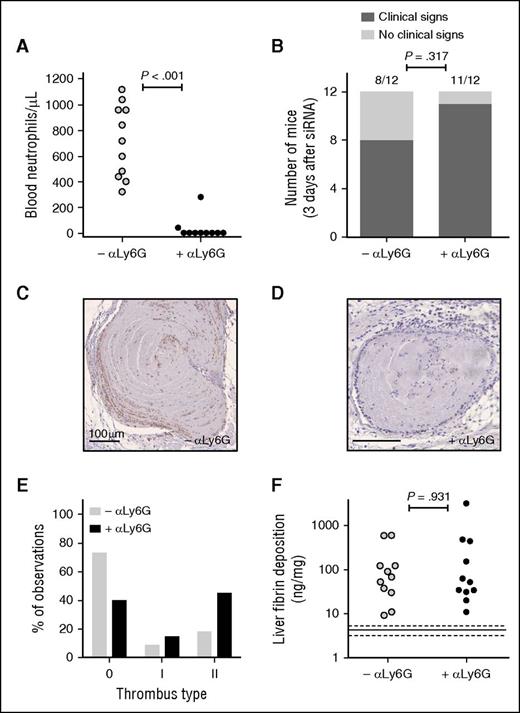 Figure 2. Depletion of neutrophils does not influence progression of thrombotic coagulopathy after siRNA-mediated hepatic knockdown of Serpinc1 and Proc. (A) Blood neutrophil numbers in mice 3 days after injection with a rat monoclonal antibody targeting mouse Ly6G (solid circles) or a rat IgG control (open circles) (Mann-Whitney rank sum test P < .001). (B) Scoring of the clinical phenotype in mice treated with siRNAs targeting Serpinc1 and Proc. Animals showing characteristic clinical signs (hatched bars) and animals unaffected (open bars) 3 days after siRNA treatment (end of experiment). One of the mice in each group (–αLy6G and +αLy6G) died as a result of the thrombotic coagulopathy (Fisher’s exact test P = .317). (C-D) Ly6G staining of thrombi found in sections of the head in (C) the –αLy6G and (D) the +αLy6G group. Hematoxylin was used for counterstaining; Scale bars represent 100 μm. (E) Scoring for the presence of thrombi: 0, no thrombi found; I and II, thrombi categories based on structure and layering. Open bars, –αLy6G (n = 22); solid bars, +αLy6G (n = 20). (F) Levels of fibrin deposition in the liver of the neutrophil-depleted group (+αLy6G) and the control group (–αLy6G) (Mann-Whitney rank sum test P = .931). Solid and dashed lines indicate fibrin levels found only in siNEG-injected C57BL/6J female mice (median, 4.5 ng/mg; range, 3.1-5.7 mg/mg).