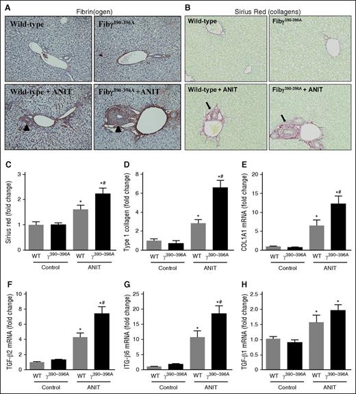 Figure 1. Increased fibrosis in livers of ANIT-exposed Fibγ390-396A mice. WT and Fibγ390-396A mice were fed a control diet (AIN-93M) or an identical diet containing 0.025% ANIT for 4 weeks. (A) Representative photomicrographs show liver sections stained for fibrin(ogen) (brown) (×200). Arrowheads indicate peribiliary fibrin(ogen) deposits. (B) Representative photomicrographs show liver sections stained for collagens with sirius red (×200). Arrows indicate peribiliary collagen deposition. (C) Sirius red and (D) type I collagen stains were quantified as described in “Methods.” Hepatic expression of mRNAs encoding the profibrogenic genes: (E) COL1A1, (F) TGFβ2, (G) ITGβ6, and (H) TGFβ1 were determined by real-time qPCR. Data are expressed as mean + standard error of the mean (SEM); mice fed a control diet (n = 4) and mice fed an ANIT diet (n = 10 to 16 mice per group). *P < .05 vs control diet within genotype; #P < .05 vs WT mice fed the same diet.
