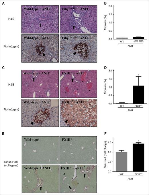 Figure 2. Hepatocellular necrosis and fibrin(ogen) deposition in livers of ANIT-exposed Fibγ390-396A and FXIII−/− mice. WT, Fibγ390-396A, and FXIII−/− mice were fed control a diet (AIN-93M) or an identical diet containing 0.025% ANIT for 4 weeks. Representative photomicrographs show liver sections stained for H&E or fibrin(ogen) (brown) from: (A) Fibγ390-396A mice, (C) FXIII−/− mice, and (A,C) corresponding WT mice exposed to ANIT. Arrows indicate areas of bile duct hyperplasia. Arrowheads indicate fibrin(ogen) deposits within areas of hepatocellular necrosis. Asterisks indicate focal hepatocellular necrosis or bile infarcts. Images are ×200 except hematoxylin and eosin (H&E) stained sections in (C), which are ×100. (B,D) Area of necrosis was determined as described in “Methods.” (E) Representative photomicrographs show liver sections stained for sirius red (×200). Arrows indicate peribiliary collagen deposition. Asterisks indicate focal hepatocellular necrosis (ie, bile infarcts). (F) Sirius red staining was quantified as described in “Methods.” Data are expressed as mean + SEM; n = 4 to 16 mice per group.*P < .05 vs ANIT-exposed WT mice.