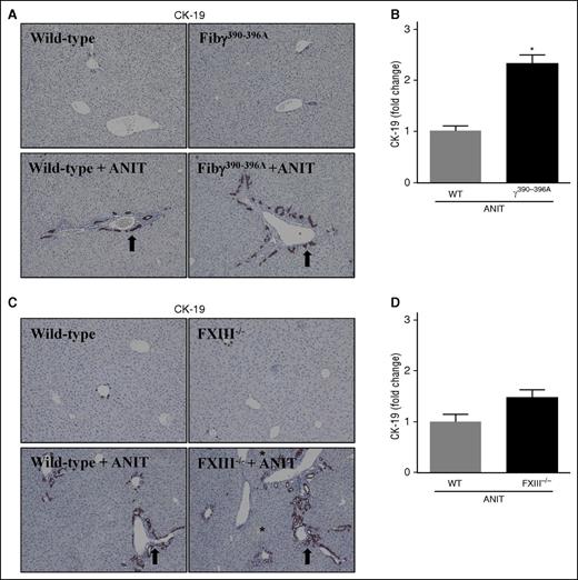 Figure 3. Biliary hyperplasia in ANIT-exposed mice. WT, Fibγ390-396A, and FXIII−/− mice were fed a control diet (AIN-93M) or an identical diet containing 0.025% ANIT for 4 weeks. Representative photomicrographs (×200) show liver sections stained for CK-19 (brown) in ANIT-exposed: (A) Fibγ390-396A mice, (C) FXIII−/− mice, and (A,C) corresponding WT mice. Arrows indicate areas of biliary hyperplasia. Asterisks indicate focal hepatocellular necrosis (ie, bile infarcts). (B,D) CK-19 staining was quantified as described in “Methods.” Data are expressed as mean + SEM; n = 4 to 16 mice per group. *P < .05 vs ANIT-exposed WT mice.