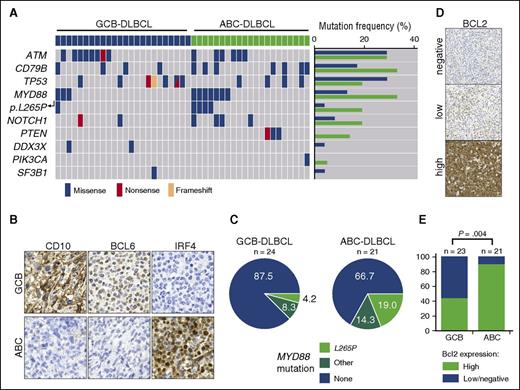 Figure 3. MYD88 mutations and high expression of BCL2 are enriched in ABC-DLBCL. (A) MYD88 mutations are substantially enriched in human ABC-DLBCL. Human DLBCLs were stratified as ABC- or GCB-DLBCL following the Hans algorithm, as depicted in (B). After immunohistochemistry-based stratification, DNA was isolated from tissue sections and subjected to targeted deep sequencing by a multiplex PCR, which covered the ATM, BTK, CD79B, DDX3X, FBXW7, MAPK1, MYD88, NOTCH1, PIK3CA, PIK3CD, PTEN, PTPN6, SF3B1, TP53, and XPO1 genes. MYD88 mutations per se, and particularly the MYD88p.L265P mutation were substantially enriched in ABC-DLBCL. Similarly, CD79B and PTEN mutations were enriched in ABC-DLBCL. (C) Distribution of MYD88 mutations detected in human DLBCL samples is shown in pie charts. The samples were classified into high and low or negative expression of BCL2, as shown in (D). (E) High protein expression levels of BCL2 are significantly enriched in ABC-DLBCL (Fisher’s exact test).