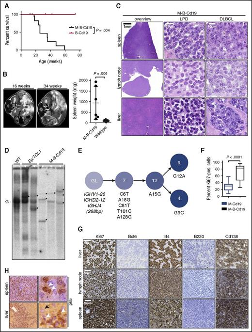 Figure 4. Combination of B-cell–specific BCL2 overexpression and Myd88p.L252P expression drives ABC-DLBCL development in vivo. (A) Kaplan-Meier curve illustrates overall survival of M-B-Cd19 mice. M-B-Cd19 mice display a significantly reduced survival compared with the respective controls (log-rank test). (B) M-B-Cd19 mice develop splenomegaly at 25 to 35 weeks. MRI scans and quantification of spleen weights at autopsy are shown (two-tailed Student t test). (C) The architecture of spleens and lymph nodes isolated from M-B-Cd19 mice was completely disrupted by a homogeneous infiltrating population of large lymphoblastoid cells (DLBCL column). Small areas of more heterogeneous lymphoid cell populations consisting of small lymphoid cells were occasionally detectable (LPD column). The livers of M-B-Cd19 mice were diffusely infiltrated by large blastoid cells with DLBCL-like morphology. (D) Variable-diversity-joining–recombination analysis by Southern blot analysis revealed the presence of clonal populations in tumors of M-B-Cd19 mice. Tumors from leukemic Eµ:TCL1 mice were used as oligoclonal controls. The germ line configuration is also present in the WT controls and is depicted as “G.” Asterisks indicate clonal rearrangements. Samples of mice with lymphoma detected by histologic analyses are marked with white triangles (top). (E) Genealogic trees of murine DLBCL isolated from M-B-Cd19 mice. Igh rearrangements were cloned and individual clones were sequenced. Analysis focused on the Ighv segments starting with FR1. Genealogic tree was derived from 32 sequences. The tree-like structures demonstrate ongoing somatic hypermutation. Numbers in circles show number of sequence reads; numbering of mutations is in regard to the germ line sequence of Ighv1-26. (F) The Ki-67 index of DLBCL lesions from M-B-Cd19 mice was significantly higher than that in M-Cd19 mice (P = 2.27 × 10−12, two-tailed Student t test; n = 3 mice per genotype; 20 fields of view per lesion). (G) Lymphoma infiltrates of M-B-Cd19 mice were immunohistochemically analyzed and stained positive for Irf4 and Cd138 and negative for B220 and Bcl6. The Ki-67 stainings are quantified in (F).