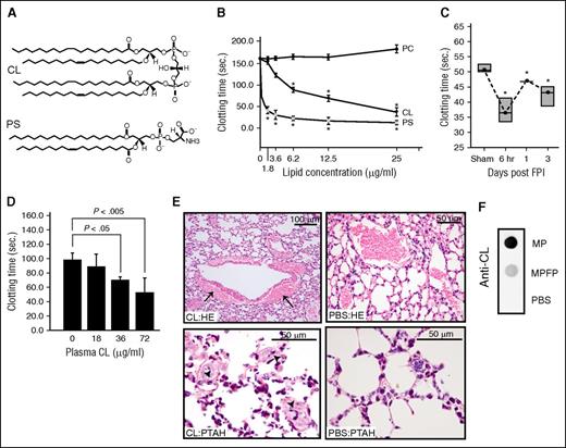 Figure 2. CL was procoagulant and microparticle-bound. (A) A structural comparison between CL and PS. (B) The time to clot of phospholipid-depleted plasma in the presence of purified CL, PS, or PC (n = 6; 1-way ANOVA, *P < .01 vs PC). (C) Clotting times of plasma collected at different points from C57BL/6J mice subjected to FPI or sham surgery (n = 6; 1-way ANOVA, *P < .01 vs sham mice). (D) Clotting time of plasma collected from non-injured C57CL/6J mice 30 minutes after CL injection (n = 6/group; 1-way ANOVA). (E) hematoxylin and eosin (HE, top) and phosphotungstic acid-haematoxylin (PTAH, bottom) stains of the lungs show perivascular accumulation of erythrocytes resulted from vascular leakage (top left) and intravascular fibrin deposition (arrow, bottom left) in mice injected with CL, but not those injected with PBS (right panels, 5-10 evaluations/treatment). (F) Anti-CL antibody detected CL in microparticles, not microparticle-free plasma (MPFP) collected from mice 6 hours after FPI (MPFP was prepared as previously described12).