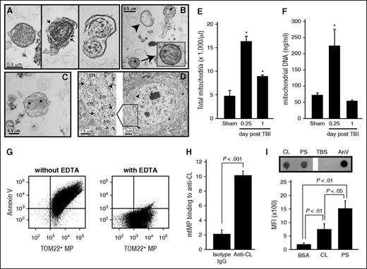 Figure 3. mtMPs were detected in plasma from FPI mice and contained surface-exposed CL. Transmission electron microscope images. (A) Intact (left) and membrane-disrupted (middle, arrow) mitochondria and mitochondria-embedded BDMP (right; asterisk, mitochondria) detected in plasma of FPI mice. (B) Mitochondria (asterisk), membrane microparticles (arrowhead), and (C) mitochondria-embedded membrane microparticles (*) from purified BDMPs. (D) A section of an uninjured mouse brain shows a dense perinuclear distribution of mitochondria (left, arrowhead: nuclear membrane). A locally enlarged image further shows mitochondria (asterisk) and endoplasmic reticulum (ER) and membrane-bound/free polyribosomes (arrow). (E) Total mtMPs and (F) mtDNA detected in plasma samples from sham and FPI mice. (G) Annexin V bound to more than 80% of mtMPs purified by TOM22 antibody (left), and the binding was abolished by EDTA (right). (H) Anti-CL antibody purified from FPI mice, but not a control IgG, bound purified mtMPs. (I, top) CL and PS captured to the nitrocellulose membrane were incubated with human annexin V (PBS and annexin V as controls). Annexin V bound to the phospholipids was detected by a polyclonal annexin V antibody. (Bottom) Allophycocyanin-conjugated annexin V bound to CL and PS coated on microbeads detected by flow cytometry (n = 3-6/group; paired Student t test).