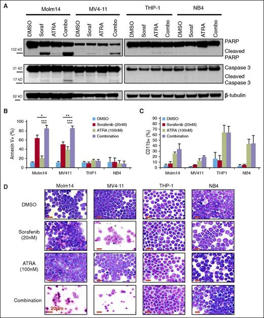 Figure 2. Sorafenib plus ATRA induces apoptosis in FLT3/ITD cell lines. FLT3/ITD+ (Molm14, MV4-11) and FLT3/WT (THP-1, NB4) leukemia cell lines were treated with sorafenib (Soraf, 20 nM) and/or ATRA (100 nM). (A) Expression of caspase 3 and PARP cleavage by western blotting of cell lysates at 24 hours. (B) AnnexinV binding at 48 hours, represented by average of 3 independent experiments. Error bars indicate average ± SD (*P < .05, **P < .01, ***P < .001). (C) CD11b expression by flow cytometry at 72 hours, represented by average of 3 independent experiments. Error bars indicate average ± SD. (D) Cellular morphology at 72 hours by Wright-Giemsa staining, magnification ×50. Increased levels of cell death are observed in sorafenib- and combination-treated FLT3/ITD+ cells, whereas evidence of differentiation is apparent in ATRA-treated cells. Red scale bar represents 20 µm. PARP, poly (ADP-ribose) polymerase.