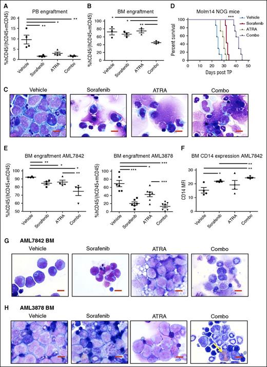 Figure 5. ATRA and sorafenib improve disease progression of AML and survival in mouse xenograft models. (A-E) NOG mice received 1 × 105 Molm14 cells via tail vain injection on day 0, and randomly assigned cohorts of mice (n = 10) were administered the following compounds on day 3 to day 24 posttransplant: sorafenib (8 mg/kg daily), ATRA (5 mg/kg daily), sorafenib + ATRA (Combo, 8 and 5 mg/kg, respectively) or vehicle, all via oral gavage. On day 24, n = 3 mice were sacrificed at random from each cohort and analyzed for disease progression. Remaining mice (n = 7 per cohort) were monitored for survival. (A) PB engraftment on day 24, represented by percentage human CD45+ (hCD45+) cells out of total of mouse CD45+ (mCD45+) and hCD45+ cells. Data represent average of n = 3 mice per cohort ± SD (*P < .05, **P < .01). (B) BM engraftment on day 24, represented as in panel A (*P < .05, **P < .01). (C) BM cellular morphology on day 24 by Wright-Giemsa staining at ×100 magnification. Reduction in fraction of leukemic cells and increased evidence of atypical monocytic differentiation is apparent in BM cells of combo-treated mice. Red scale bar represents 10 µm. Data are representative of n = 3 mice per cohort. (D) Kaplan-Meier survival of mouse cohorts (n = 7 each), indicating median survival of vehicle (25 days), ATRA (30 days), sorafenib (32 days), and combo (42 days) treated mice (***P < .001). (E-H) NOG mice received 1 × 106 AML7842 or AML3878 primary cells via tail vain injection, and randomly assigned cohorts of mice (n = 4-7) were treated as described above for 3 weeks. At end of treatment, mice were sacrificed and analyzed for disease progression. (E) BM engraftment at end of treatment, represented as in panel A. Data represent average of n = 4-7 mice per cohort ± SD (*P < .05, **P < .01, ***P < .001). (F) BM CD14 expression in AML7842 recipient mice, represented by MFI of human CD14 in hCD45+ cells. Data represent average of n = 4 mice per cohort ± SD (*P < .05, **P < .01). (G-H) BM cellular morphology at end of treatment of (G) AML7842 and (H) AML3878 recipient mice by Wright-Giemsa staining at ×100 magnification. Reduction in fraction of leukemic cells and increased evidence of granulocytic and monocytic differentiation is apparent in BM cells of combo-treated mice. Yellow arrow indicates cell with iron particle deposition. Red scale bar represents 10 µm. Data are representative of n = 4-7 mice per cohort.