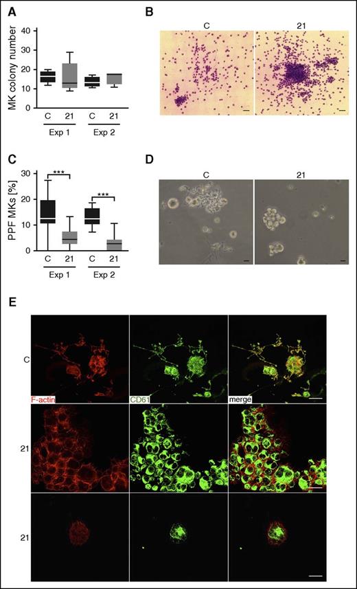 Figure 4. Repeated MK proliferation, differentiation, and proplatelet-formation studies for a R1213* variant case. (A) Total amount of CFU-MK colonies derived from a total of 5000 peripheral blood CD34+ mononuclear cells per plate from a control and from case 21 (21) at day 12 of culture. This experiment (Exp) was repeated at 2 independent occasions (Exp 1 and Exp 2). (B) Representative images of cultured CFU-MK colonies from a control and from case 21 at day 12 of culture visualized by light microscopy after staining with May-Grünwald-Giemsa stain (Exp 2). Bars represent 50 μm. (C) MKs in triplicated liquid suspension cultures performed at 2 independent occasions were classified as proplatelet forming (PPF) MKs when proplatelet extensions were visible by light microscopy. The proportion of PPF MKs was lower in the cultures from case 21 compared with controls (1-way analysis of variance, ***P > .001). (D) Representative light microscopy images of cultured MKs showing formation of proplatelet extensions for the control. PPF MKs are almost absent for case 21, although they typically present in MK clusters that contain large and small cells. Bars represent 20 μm. (E) Immunofluorescence confocal microcopy images of differentiated fibrinogen-adhered MKs at day 12 of culture visualized by anti-integrin β3 (green; CD61) and phalloidin (red; F-actin) staining, showing colocalization in MKs from control, but not from case 21. Bars represent 20 μm. Numerous PPF MKs are present in the control (representative image), whereas MKs for case 21 form clusters. C, control.