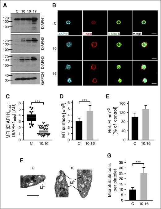 Figure 5. Altered expression of DIAPH1-3 and cytoskeletal organization in platelets from DIAPH1 R1213* variant cases. (A) Representative western blots of resolved platelet protein extracts from DIAPH1 R1213* cases 10, 16, and 17 and from a control probed with antibodies recognizing DIAPH1, DIAPH3, DIAPH2, and glyceraldehyde-3-phosphate dehydrogenase (GAPDH). Compared with the control, the DIAPH1 R1213* cases show normal expression of DIAPH1. The content of DIAPH2 and DIAPH3 is increased in the cases compared with control. Similar quantities of total protein in the western blot lanes are indicated by the control blot probed with an antibody recognizing GAPDH. (B) Representative confocal microscopy images of poly-l-lysine-immobilized resting platelets from cases 10 and 16 and from a control stained for DIAPH1 (cyan), F-actin (red), and α-tubulin (green). Platelets were visualized using a Leica TCS SP5 confocal microscope (Leica Microsystems). Bars represent 3 μm. (C) Image analysis (ratio of the mean of the first and last maxima and the mean of the first and last minima) revealed an aberrant distribution of DIAPH1 in platelets from cases 10 and 16 as compared with controls. Box plots display first and third quartiles, and whiskers mark minimum and maximum values unless exceeding 1.5 times the interquartile range of at least 50 platelets per group; symbols represent outliers, and the horizontal line displays the median. Wilcoxon-Mann-Whitney test, ***P < .001. (D-E) Quantification of the immunostained α-tubulin surface (D) and fluorescence intensity per surface unit of the F-actin staining (E) revealed an increased content and an abnormal distribution in platelets from the cases. Values represent means ± SD (n = 3 controls vs case 10 and 16; 100 platelets). Wilcoxon-Mann-Whitney test, ***P < .001. (F) Representative transmission electron micrographs showing that the microtubules (indicated by arrows) are disorganized and distributed throughout the cytoplasm of platelets from case 10 compared with controls in which microtubules are organized into the marginal band. Images were collected using an EM900 (Carl Zeiss) electron microscope. Bars represent 0.5 μm. (G) Manual counting of microtubules revealed an increased number of microtubules in platelets from the cases (n = 41 platelets) compared with controls (n = 104 platelets). Microtubule numbers per platelet are expressed as mean ± SD. Unpaired Student t test, ***P < .001. AU, arbitrary units; MFI, mean fluorescence intensity; MT, microtubule; Rel. FI, relative fluorescence intensity; SD, standard deviation.