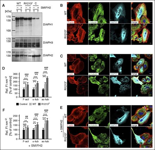 Figure 7. Overexpression of DIAPH1 R1213* in cell lines reproduces the cytoskeletal alterations in platelets. (A) Western blot of protein extracts from HEK293FT cells transfected with DIAPH1 WT (WT), DIAPH1 R1213* (R1213*), or empty (C) expression constructs, probed with antibodies recognizing the DIAPH1 amino terminus, DIAPH3, or DIAPH2. Confocal microscopy images of A549 cells transiently transfected with the DIAPH1 WT or R1213* expression constructs were stained for F-actin (red), α-tubulin (green), and DIAPH1 (cyan) (B) and for F-actin (red), ac-tub (green), and DIAPH1 (cyan) (C) and with DAPI nuclear counterstain (blue) (B-C). (D) Quantification of the relative fluorescence intensity per surface unit of transfected and nontransfected cells revealed an increased content of F-actin, α-tubulin, and ac-tub in the cells overexpressing DIAPH1 R1213* compared with adjacent nontransfected cells (differences are indicated by asterisks) and DIAPH1 WT–overexpressing cells (differences are indicated by pound signs). (E-F) Incubation with the FH2 domain inhibitor SMIFH2 reduced F-actin content, but not the content of microtubules and ac-tub as determined by quantification of the relative fluorescence intensity per surface unit. Values in panels D and F are expressed as means ± SD (n = 100 cells). Wilcoxon-Mann-Whitney test, **,##P < .01; ***,###P < .001. The cells in panels B, C, and E were visualized using a Leica TCS SP5 confocal microscope (Leica Microsystems). Bars represent 10 μm.