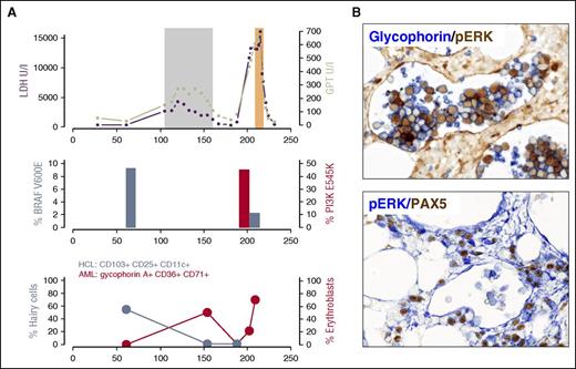 Figure 3. AML-M6 evolution and vemurafenib treatment. (A) Upper image: during vemurafenib treatment (gray box) lactate dehydrogenase (LDH; purple) levels (maximum 4297 U/L, normal range <250 U/L) and transaminases (green) increased. LDH levels were above normal levels before vemurafenib was administered, but liver enzymes rose with vemurafenib. During vemurafenib treatment, fluorescence-activated cell sorting demonstrated 40% of erythroblasts (red: glycophorin A+, CD36+, CD71+, CD34−) in the peripheral blood. After stopping vemurafenib, the LDH levels and liver enzymes returned to normal and erythroblasts disappeared from the peripheral blood (upper and lower images), suggesting dependence on vemurafenib. At 1.8 months after the stop of vemurafenib treatment, erythroblasts with the above-mentioned immunophenotype were again found in the peripheral blood, accompanied by massively elevated liver enzymes and LDH levels exceeding 16 000 U/L. BRAF V600E allele frequency (steel blue, middle image) and hairy cells (CD25, CD103, CD11c; steel blue, lower image) were significantly reduced upon vemurafenib treatment, whereas AML with PI3KCA mutation (E545K) emerged in the AML clone (middle image). We performed deep sequencing (Ion Torrent, >16 000 reads) on a trephine biopsy sample taken 44 days before vemurafenib was administered. The PI3KCA mutation E545K could not be confirmed within the sensitivity of the assay. (B) Immunohistochemistry revealed the strong positivity of p-ERK in glycophorin A+ intrasinusoidal erythroblasts (bone marrow biopsy) as a sign of ERK activation. Original magnification ×40. Orange box indicates AML induction treatment. GPT, glutamate pyruvate transaminase.