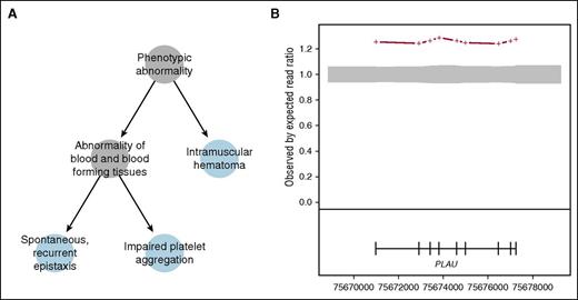 Figure 5. Case study. (A) HPO encoded phenotype of a case in the “suspected” category, visualized as a graph using the hpoPlot package. Note that “abnormality of leukocytes” is also an “abnormality of the immune system” (not shown). (B) The ratio between observed and expected read depth over the PLAU gene for the case (red) and superimposed over the 95% confidence interval (gray shaded area). In the lower panel, the central position of each exon of the PLAU gene is shown as a vertical bar and the gene coordinates are provided on the horizontal axis. The data indicate that the case carries an additional copy of the PLAU gene (Bayes factor = 145), which is compatible with a diagnosis of suspected Québec platelet syndrome.