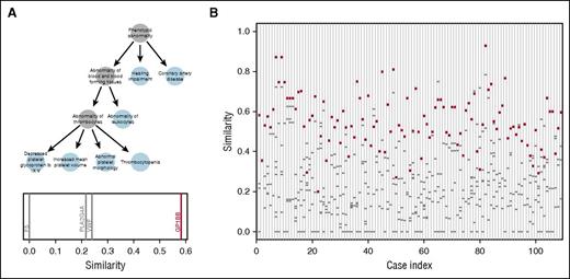 Figure 6. HPO-based prioritization. (A) HPO profile of a case with BSS encoded as a graph. Note atypical presence of hearing impairment, which is likely unrelated to the BSS. The plot beneath the graph shows the similarities between the patient profile and each gene in which the case has a candidate variant. The profile of GP1BB is the most similar out of the 4 genes with candidate variants. (B) For each of the 109 HPO-coded cases for which a causative variant was assigned by the MDT, the similarity is shown between the case profile and the profiles of the genes in which the case has a candidate variant. The similarity to the gene containing the variant(s) determined to be pathogenic or likely pathogenic in each case (red circles) and the similarity to other genes containing VUS (gray dashes) are shown. Case index 1 corresponds to the BSS case shown in (A).