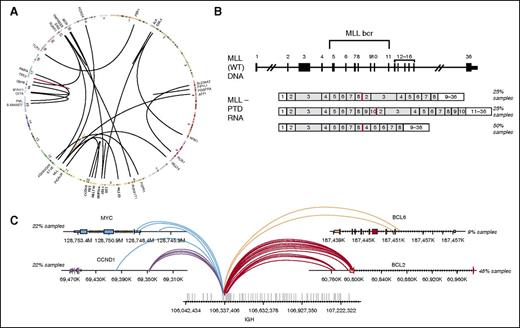 Figure 3. Combined DNA and RNA sequencing for detection of complex rearrangements. (A) Circos plot showing broad range of fusions in cell line mixes used for validation of fusion calling. (B) Three MLL-PTD isoforms that were tested (from top to bottom): duplication of MLL exons 2 to 8, exons 2 to 10, and exons 4 to 8. (C) Breakpoints on the IGH and its partner genes for the 13 clinical concordance samples including 5 IGH-MYC, 2 IGH-BCL6, 5 IGH-CCND1, and 11 IGH-BCL2 rearrangements.