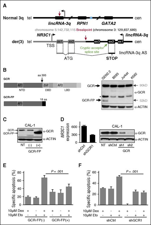 Figure 2. The t(3;5)-encoded GCR-lincRNA-3q fusion protein is associated with glucocorticoid resistance. (A) Schematic representation of the genomic organization surrounding the normal 3q and der(3) breakpoint regions, indicating the resulting fusion transcript NR3C1-lincRNA-3q. The blue filled circle denotes the GATA2 superenhancer. In black, 3q sequences. In gray, 5q sequences. The NR3C1-lincRNA-3q fusion transcript likely derives from a splicing event between NR3C1 exon 2 and a cryptic splice acceptor site located in the antisense orientation in lincRNA-3q exon 2 (chromosome 3:129,832,478). (B) Schematic representation of the structure of wild-type GCR (top left) and predicted GCR-FP (bottom left). GCR and ACTIN western blot analyses showing expression of an abnormal GCR isoform (GCR-FP) exclusively in GEN2.2 cells compared with t(3;5)-negative cell lines, as indicated (right); * denotes nonspecific band. (C) Western blot using anti-GCR and anti-ACTIN antibodies in the parent CAL-1 cell line (nontransduced; NT) compared with CAL-1 cells transduced with empty GFP vector (−) or with the GFP-tagged GCR-FP expression vector (+), as indicated (n = 2). (D) Western blot using anti-GCR and anti-ACTIN antibodies in the parent CAL-1 cell line (NT) compared with CAL-1 cells transduced with shCtrl or shGCR (n = 2 independent hairpins, shGCR1 and 2), as indicated (right). Affymetrix NR3C1 messenger RNA expression in shGCR1 compared with shCtrl-transduced cells (experimental haploinsufficiency, n = 3) (left). (E) Evaluation of drug sensitivity of CAL-1 cells overexpressing GCR-FP compared with control CAL-1 cells after 16 hours of treatment with 10 μM etoposide (Eto), 72 hours of treatment with 10 μM dexamethasone (Dex), or a combination of both treatments. Specific apoptosis was measured by AnnexinV/propidium iodide staining and flow cytometry, and calculated as follows: (% drug-induced cell death − % control cell death) ÷ (100 − % control cell death) × 100. P value determined by Wilcoxon test; n = 3. (F) Evaluation of drug sensitivity of CAL-1 cells shGFP compared with shCtrl as described in panel E. aa, amino acid; AF, activation function domain; cen, centromere; DBD, DNA binding domain; LBD, ligand binding domain; ex, exon; NTD, N-terminal domain; tel, telomere; TSS, transcription start site; ZnF, zinc finger domain.