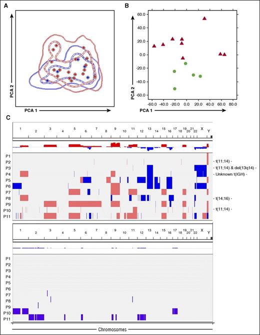 Figure 1. Phenotypic, transcriptomic, and genomic features of clonal plasma cells in AL. (A) Immunophenotypic protein expression profiles of clonal plasma cells from patients with AL (red) and MGUS plus MM (blue). These latter patients were initially screened for bone marrow clonality using the same immunophenotypic approach because of suspected AL, but were finally diagnosed as having MGUS (n = 3) and MM (n = 3). In the principal component analysis (PCA) graphic view, every patient is represented by a single dot, and disease reference groups by 1 (dashed lines) and 2 (solid lines) standard deviation curves. (B) Unsupervised PCA shows differences in gene expression profiling between clonal PCs from patients with AL (red) and normal PCs from healthy donors (green). (C) Overview of CNAs and copy number neutral loss of heterozygosity (CNN-LOH) detected in clonal PCs from patients with newly diagnosed AL. Samples are distributed in the y-axis and chromosome location in the x-axis. Red shading indicates the presence of copy number gains, and blue indicates copy number losses. CNAs were reported when the 3 following criteria were met: ≥25 consecutive imbalanced markers per segment, ≥100 Kb minimum genomic size, and <50% overlap with paired control DNA and/or genomic variants of Toronto DB (DGV). Those cytogenetics alterations detected by FISH in each individual patient are detailed at the beginning of the corresponding row. CNN-LOH are represented by violet bars. Only CNN-LOH >5 Mb, with ≥25 consecutive imbalanced markers per segment, and <50% overlap with patient-paired CNAs were considered.