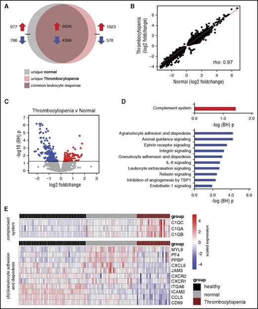 Figure 6. The leukocyte genomic responses and associated biological pathways in sepsis patients with thrombocytopenia, in the propensity matched cohort. (A) Venn-Euler representation of differentially expressed genes in sepsis patients with very low platelet counts (<50 × 109/L, thrombocytopenia) and normal platelet counts (150 × 109 to 399 × 109/L, normal) vs healthy subjects (adjusted P < .05). Red arrows denote overexpressed genes; blue arrows denote underexpressed genes. (B) Dot plot depicting the common response (log2 foldchanges) of patients with very low and normal platelet counts as compared with healthy subjects. ρ, Spearman’s correlation coefficient. (C) Volcano plot illustrating the differences in leukocyte genomic responses (integrating log2 foldchanges and multiple-test adjusted probabilities) between sepsis patients with thrombocytopenia (<50 × 109/L) and normal counts (150 × 109 to 399 × 109/L). Considering adjusted P < .05, 234 genes were identified as differentially expressed. Red dots denote significantly overexpressed genes, whereas blue dots denote significantly underexpressed genes in thrombocytopenic patient samples. Horizontal black line indicates multiple-test adjusted (BH) P < .05 threshold. (D) Overexpressed genes in thrombocytopenic sepsis patients associated with the complement signaling pathway (red bar). Underexpressed genes associated with predominantly leukocyte mobility, adhesion, and extravasation pathways (blue bars). –log (BH) p, negative log-transformed BH adjusted P values. (E) Heatmap plots of significantly (adjusted P < .05) differential gene expression indices pertaining to the complement system and (A) granulocyte adhesion and diapedesis pathways. Red rows denote overexpression; blue rows denote underexpression.