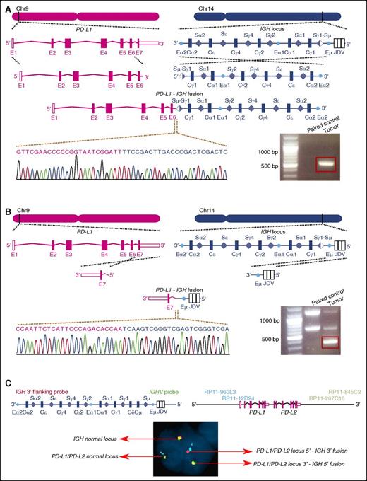 Figure 1. Identification of the PD-L1–IGH translocation in sample DL48. (A-B) The positions of the breakpoints in the 2 loci are indicated. The translocation is balanced, resulting in 2 distinct fusion chromosomes. Breakpoint-specific PCR and Sanger sequencing confirm the WGS results. The red box indicates the PCR product with expected size. The 100-bp plus ladder from Life Technologies was used. (C) FISH analysis of sample DL48 shows the colocalization of the probe signals of PD-L1 and IGH. The 5′ end of IGH appears in green, and the 3′ end in red. The probe targeting the 5′ end of the PD-L1/PD-L2 locus was labeled in cyan and the probe targeting the 3′ end in gold.