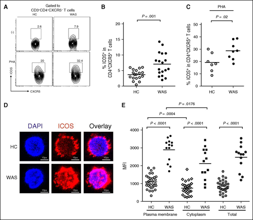 Figure 3. WAS patients display more ICOS expression in CD4+ CXCR5+ T cells. (A) Flow cytometric analysis of ICOS+ cells in whole blood and stimulated PBMCs from WAS patients and HCs. (B) Percentage of ICOS+ cells within CD4+CXCR5+ T cells in WAS patients (n = 18; P1-P18) and HCs (n = 18). (C) Percentage of ICOS+ cells within CD4+CXCR5+ T cells after stimulation with PHA for 3 days in WAS patients (n = 8; P1-P8) and HCs (n = 7). (D) Representative images of ICOS staining in Tfh cells from HCs and WAS patients. Scale bar, 2.5 μm. (E) MFI of ICOS on the plasma membrane and cytoplasm of Tfh cells from HCs and WAS patients.