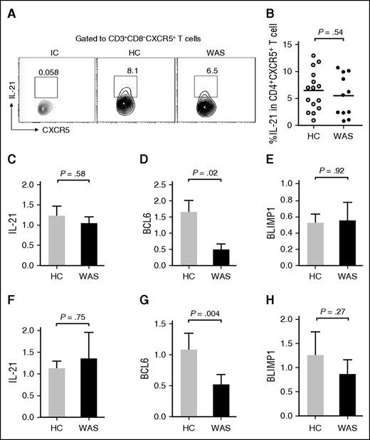 Figure 4. Cytokine secretion and expression of transcription factors in WAS. (A) Flow cytometric analysis of IL-21+ cells in WAS patients and HCs. (B) Percentage of IL-21+ cells within CD4+CXCR5+ T cells in WAS patients (n = 11; P1-P11) and HCs (n = 15). (C) Gene expression of IL-21 mRNA of CD4+ T cells in WAS patients (n = 5; P1, P6-P9) and HCs (n = 6). (D) Gene expression of BCL6 mRNA of CD4+ T cells in WAS patients (n = 5) and HCs (n = 6). (E) Gene expression of PRDM1 mRNA of CD4+ T cells in WAS patients (n = 5) and HCs (n = 6). (F) Gene expression of IL-21 mRNA of Tfh cells in WAS patients and HCs (n = 6). (G) Gene expression of BCL6 mRNA of Tfh cells in WAS patients and HCs (n = 6). (H) Gene expression of PRDM1 mRNA of Tfh cells in WAS patients and HCs (n = 6).