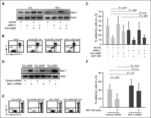 Figure 3. Mcl-1 mediates ABT-199 resistance. (A-C) CLL cells were transfected with control (siCont) or Mcl-1 (siMcl-1) siRNA, split and cultured with or without imm-aIgM for 3 hours prior to the addition of ABT-199 (2 nM). The levels of Mcl-1 protein were evaluated by immunoblotting of cellular extracts collected 3 and 18 hours after the addition of imm-aIgM. The percentage of viable cells was determined by annexin V/PI staining 20 hours after the addition of imm-aIgM. One representative experiment is shown in panels A and B, respectively. Summary of the data from 5 independent experiments evaluating leukemic cell viability is shown in panel C. Significance of differences in leukemic cell viability was evaluated with the paired Student t test. (D-F) CLL cells were transfected with Mcl-1 or control mRNA. ABT-199 was added after 3 hours, when Mcl-1 protein levels reached maximum, and was removed 3 hours later when Mcl-1 protein levels started to substantially decline (Mcl-1 protein half-life is <1 hour). The ABT-199 concentration in these experiments was increased from 2 nM to 4 nM because of the shorter exposure to the drug. Levels of Mcl-1 protein in CLL cells collected 3 hours postnucleofection are shown in panel D. Analysis of leukemic cell viability in 1 representative sample 20 hours after nucleofection is shown in panel E, whereas summary of data from 5 different experiments evaluating leukemic cell viability is shown in panel F. Significance of differences was evaluated with the paired Student t test.