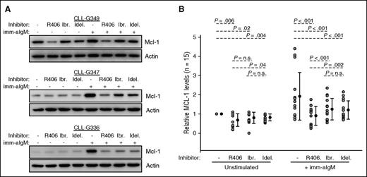 Figure 4. SYK inhibitor R406 more potently downregulates Mcl-1 than BTK inhibitor ibrutinib or PI3Kδ inhibitor idelalisib. (A) CLL cells were preincubated for 2 hours with 1 μM of the indicated BCR inhibitor and then stimulated with imm-aIgM for additional 20 hours. Cellular extracts were prepared and analyzed by immunoblotting with the indicated antibodies. Three representative experiments of the 15 performed are shown. Additional experiments are shown in supplemental Figure 3. (B) Changes in relative Mcl-1 levels in the 15 investigated samples are plotted on the chart. Analysis of differences between untreated and inhibitor-treated samples was done with the Wilcoxon signed-rank test.