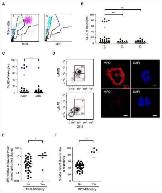 Figure 1. Analysis of MPO deficiency in an MPN patient cohort. (A) Peripheral blood ADVIA dot plots from a patient with MF and normal MPO activity (left), and a patient with MF and acquired MPO deficiency (right). LUC (light blue), neutrophil granulocytes (purple), monocytes (green), lymphocytes (dark blue), eosinophil granulocytes (orange), and platelets/lysed red blood cells (black) are shown. The numbers indicate the percentage of LUC in peripheral blood leukocytes. (B) Percentage of LUC in peripheral blood leukocytes from patients with MF (n = 81), ET (n = 94), and PV (n = 142). Patients with a CALR mutation and MPO deficiency (dark blue dots); patient 1 analyzed in more detail in Figure 2 (light blue dot); and patient 6 with a JAK2 mutation and MPO deficiency (red dot) are shown. (C) Percentage of LUC in peripheral blood leukocytes from patients with stratified according to the presence of a CALR (n = 29) or a JAK2 (n = 43) mutation. (D, left) Intracellular detection of MPO protein by flow cytometry in neutrophil granulocytes of a patient with MF and normal MPO activity (top), and a patient with MF and acquired MPO deficiency (bottom). The numbers indicate the percentage of cells in the gate. (D, right) Detection of MPO protein by confocal microscopy in neutrophil granulocytes of a patient with MF and normal MPO activity (top), and a patient with MF and acquired MPO deficiency (bottom). Scale bar, 5 μm. (E) Relative expression of MPO mRNA measured by qPCR and normalized to that of porphobilinogen deaminase in neutrophil granulocytes of patients with MF and normal MPO activity (n = 32), and patients with MPO deficiency (n = 6). (F) Correlation of the presence of MPO deficiency with the mutant allele burden of CALR. The median in each dot plot is represented as a green or black line. *P < .05; **P < .01; ***P < .001 (Mann–Whitney U test). cyMPO, cytoplasmic MPO.