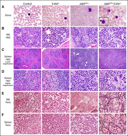 Figure 3. Histopathologic analysis. (A) Representative peripheral blood smears (×1000 magnification) from control, Ezh2−/−, Jak2VF/+, and Jak2VF/+ Ezh2−/− mice at 24 weeks after pI-pC injection are depicted. The Jak2VF/+ Ezh2−/− blood film shows leukoerythroblastic anemia, with predominance of nucleated RBC and neutrophils; a rare blast is shown in the inset. (B) Hematoxylin and eosin staining of representative BM sections (×500 magnification) from control, Ezh2−/−, Jak2VF/+, and Jak2VF/+ Ezh2−/− mice at 24 weeks after pI-pC injection is shown. (C-D) Hematoxylin and eosin–stained spleen sections from control, Ezh2−/−, Jak2VF/+, and Jak2VF/+ Ezh2−/− mice at lower (×40) and higher (×500) magnifications are presented. (E-F) Reticulin staining on representative (E) BM and (F) spleen sections (×500 magnification) from control, Ezh2−/−, Jak2VF/+, and Jak2VF/+ Ezh2−/− mice at 24 weeks after pI-pC injection are shown. Note that concomitant deletion of Ezh2 in Jak2V617F mice results in extensive fibrosis in the BM and spleens, with leukoerythroblastic anemia and thrombocytosis in the blood.