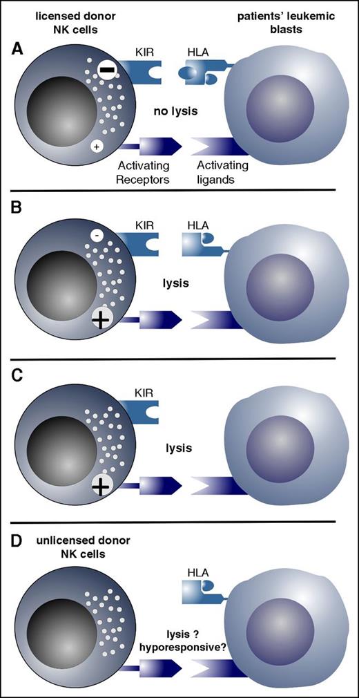 Figure 2. Possible constellations of NK cell alloreactivity are depicted. (A) Licensed donor NK cells (ie, NK cells that have iKIRs for self–HLA class I) are inhibited via engagement of the iKIR by the recipients’ ligands (HLA class I), which exert a strong inhibitory signal; thus, these donor NK cells cannot lyse recipients’ leukemic blasts (NK cell nonalloreactivity). (B) iKIRs of licensed NK cells are not engaged by the KIRLs, and the donor NK cells are activated and lyse recipients’ leukemic blasts (NK cell alloreactivity). (C) Recipients’ blasts lack HLA class I expression and, therefore, cannot inhibit donor NK cells, resulting in activation of donor NK cells. (D) NK cells do not express KIRs and, therefore, have not been licensed. KIR-negative NK cells are one of the earliest lymphocyte populations that reconstitute after T cell–depleted HSCT. These NK cells are hyporesponsive but might become responsive upon cytokine stimulation.