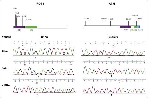 Figure 6. Validation of candidate driver genes POT1 and ATM. Schematics of each protein are shown with the locations of mutations identified (top). Sanger validation of SNVs in lesional skin, diagnostic blood samples, and mRNA isolated from CD4+-enriched tumor cells (bottom).
