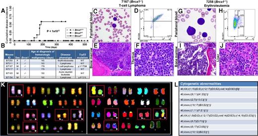 Figure 2. Brca1 deficiency increases susceptibility of mice to HMs characterized by leukemic infiltration of multiple organs consistent with the Bethesda criteria.14,15 (A) Cumulative disease incidence curves for Brca1+/+ (dash-dot-dot line), Brca1+/− (dashed line), and Brca1−/− (solid line) mice. Statistical significance was calculated by using the log-rank test. The number of mice in each cohort at each time point analyzed is listed in supplemental Figure 9H. (B) Characteristics of diseased mice and specific HM diagnosis. Presence or absence of a Trp53 mutation in each tumor is indicated. (C-F) Organs isolated from 7167, a Brca1−/−mouse that developed a T-cell lymphoma. (C) PB smear with Wright-Giemsa stain showing the presence of lymphoma cells (magnification ×10). (D) PB flow cytometry analysis using antibodies against T-lymphoid markers CD4 and CD8, showing the malignant cells to be CD4+/CD8+. (E) BM stained with hematoxylin and eosin (H&E), showing extensive involvement with lymphoma (magnification ×10). (F) Thymus stained with H&E, showing effacement of the normal thymic architecture by infiltrating lymphoma cells (magnification ×50). (G-J) Organs isolated from B7258, a Brca1−/− mouse that developed an erythroleukemia. (G) PB smear with Wright-Giemsa stain showing many erythroid blasts (magnification ×50). (H) PB flow cytometry analysis using antibodies against CD71 and Ter119. (I) BM stained with H&E, showing extensive leukemic involvement (magnification ×10). (J) Liver stained with H&E, showing extensive infiltration by leukemic cells (magnification ×50). (K) Spectral karyotyping analysis of erythroleukemia cells from a secondary transplant recipient mouse revealed an abnormal clone characterized by structural rearrangements: karyotype: 40,XX,t(1;15)(D;E), t(12;17)(D3;E2), and del(14)(D3E3). (L) Cytogenetic abnormalities identified within the erythroleukemia. del, deletion; idem, the same as the stemline clone listed first.