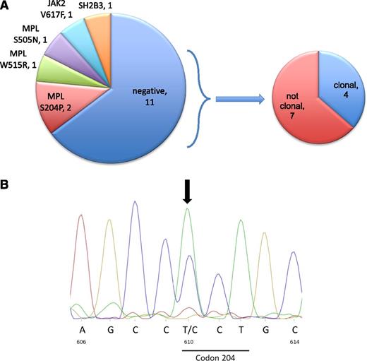 Figure 1. Genomic analysis. (A) A schematic representation of the signaling mutations in the 17 patients and of the type of hematopoiesis in triple-negative ETs. We consider as polyclonal ETs the patients that exhibit no mutation (driver or passenger) in WES. (B) Sanger sequencing of MPLS204P. Nucleotides and amino acid numbers are indicated.