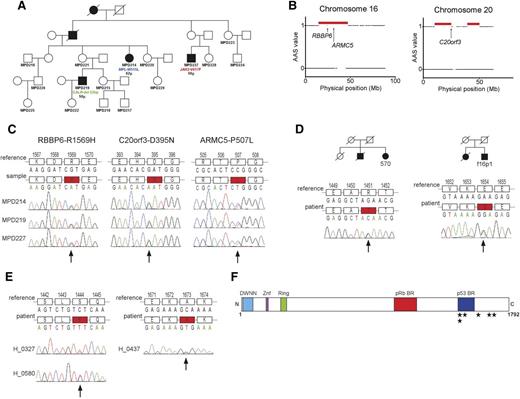 Figure 1. Identification of the germline mutation causing MPNs in the Australian family and screening in other MPN cases. (A) Family tree of the Australian family. The patients with mutations in JAK2, MPL, and CALR are marked. Below the mutations, the age at diagnosis is indicated. (B) Genomic regions shared by the 3 affected members in the family identified by the segregation exclusion analysis (red horizontal bars). Arrows indicate the physical position of the candidate genes RBBP6, ARMC5, and C20orf3. (C) Validation of the mutations in RBBP6, ARMC5, and C20orf3 segregating with the disease in the pedigree. The locations of mutations are marked with an arrow. (D) The RBBP6 mutations found in familial cases of MPNs. The respective family trees are shown. For both families, DNA was available only from 1 member and the segregation of the mutation with MPN was not possible to establish. (E) The 2 unique RBBP6 mutations found in 3 sporadic cases of MPNs. (F) The schematic structure of the RBBP6 protein with known and predicted domains. The locations of the detected mutations that are not observed in healthy controls are shown with stars. AAS, absence of allele-sharing; BR, binding region; DWNN, domain with no name; Mb, megabase pair; Znf, zinc finger domain.