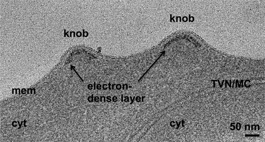 Figure 1. Knobs in the membrane of a P falciparum–infected erythrocyte have an underlying electron-dense layer. Average of 20 slices from a tomogram of a high-pressure-frozen, freeze-substituted schizont, showing knobs in the erythrocyte membrane and underlying electron-dense material. cyt, erythrocyte cytoplasm; mem, erythrocyte membrane; TVN/MC, tubulovesicular network/Maurer's cleft.