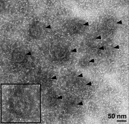 Figure 2. Knobs are visible as dark patches in electron micrographs of detergent-extracted schizont skeletons. Electron micrograph showing several knobs (arrowheads) in a negative-stained schizont skeleton, with surrounding cytoskeletal material. Inset: Twofold enlarged view of the knob at bottom left.