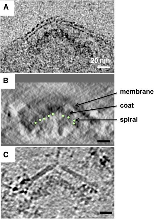 Figure 4. The electron-dense coating layer lies between the spiral and the membrane. Comparison of side-view sections through knobs in tomograms of schizont material prepared using different methods, showing layered arrangement of spiral, coat layer, and membrane; averages of 10 tomographic slices through the knob apex. (A) High-pressure-frozen, freeze-substituted schizont showing membrane bilayer and underlying electron-dense material. (B) Negative-stained detergent-insoluble schizont skeleton; contrast inverted to match (A) and (C). The path of the spiral coil through the tomogram section is indicated by green circles. Some membrane remains after detergent extraction. View orthogonal to the plane of the tomogram. (C) Schizont skeleton in vitreous ice, showing partially detergent-extracted membrane and underlying electron-dense material. A sharp discontinuity is present at the apex and in the coat layer.