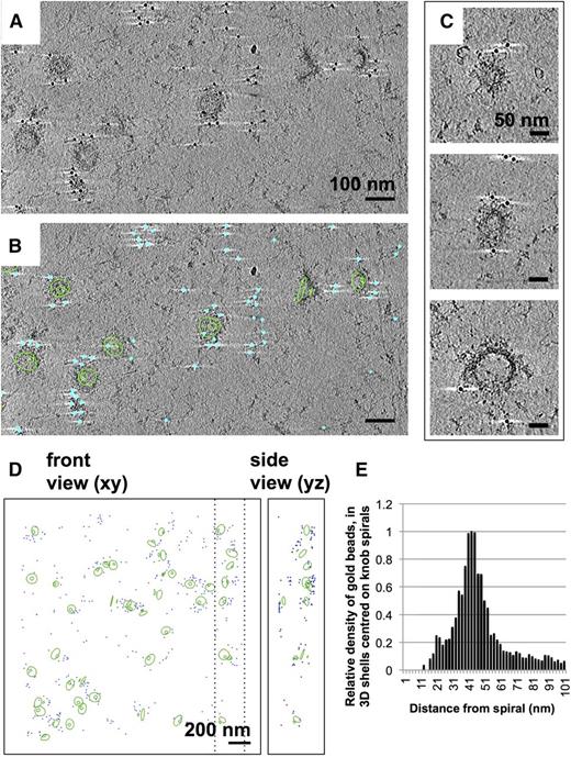 Figure 6. Immuno-EM labeling of KAHRP in knob skeletons. (A). Thick section (average of 50 slices) from a cryotomogram of schizont skeleton labeled with anti-KAHRP antibody 18.2 and 10-nm gold-conjugated secondary antibody. (B) The same field of view shown in (A), with 70 slices of a 3-D model overlaid, describing knob spirals by the first and last turn (green contours), and gold beads as cyan spheres. (C) Sections (30 slices each) through individual knobs in a cryotomogram of schizont skeleton labeled with mAb 18.2 and gold-conjugated secondary antibody, showing spiral structure with radiating pattern and gold labeling on the coat layer. Connected cytoskeleton is also visible. (D) Model showing spirals as first and last turn (green contours) and gold label (cyan spheres) in a cryotomogram of schizont skeleton labeled with anti-KAHRP antibody 18.2. Dashed lines mark the boundaries in x of the volume shown in the side view. (E) Chart showing the average density of gold beads at a given radial distance (in 3-D) from knob spirals in 4 cryotomograms of schizont skeletons labeled with KAHRP antibody 18.2 and 10-nm gold-conjugated secondary antibody.