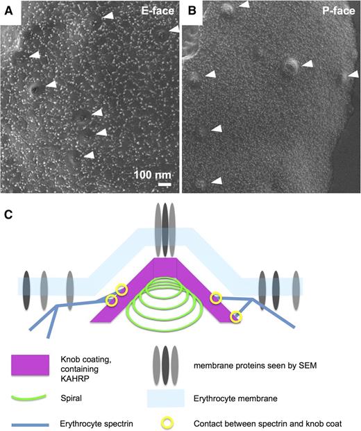 Figure 7. Knob membranes have a distinct distribution of membrane proteins. Cryoscanning EM images of freeze-fractured schizont coated with 4 nm chromium, showing erythrocyte membrane proteins. The knobs are clearly recognizable as indentations (A) or protrusions (B). Membrane proteins are visible as small lighter-shaded bumps forming various patterns on the surface. (A) E-face (inside of the outer membrane leaflet). (B) P-face (outside of inner membrane leaflet). Knobs are indicated by white arrowheads. (C) Schematic of the knob structure, showing the spiral with coat layer underlying the erythrocyte membrane, and erythrocyte spectrin connecting to the outside of the coat layer. Membrane proteins are present at the knob apex and in the surrounding erythrocyte membrane, but are otherwise sparse in the knobs.
