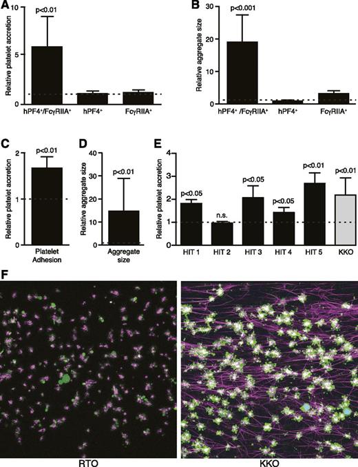 Figure 1. In vitro microfluidic thrombosis model of HIT. (A) Kinetic quantitative fluorescence analysis of platelet accretion to VWF-coated surfaces after perfusion of citrated whole blood from transgenic mice. Data are expressed as relative platelet accretion calculated from area under the curve (AUC) of percent area covered by platelets (AUC of sample stimulated with KKO divided by AUC of sample stimulated with RTO). Dotted line represents no additional activation with KKO compared with RTO. Mean ± SEM is shown. N = 8, 6, and 5 for each transgenic line, respectively. (B) Same studies analyzed for relative platelet aggregate size. (C) Kinetic quantitative fluorescence analysis of platelet accretion to VWF-coated surfaces after perfusion of citrated whole human blood. Data are expressed as in (A). N = 7 with each experiment performed in duplicate. (D) Same as (B), using human blood. N = 7 with each experiment performed in duplicate. (E) Similar studies as in (C) conducted with isolated IgG from patients with clinically and serologically documented HIT compared with normal hIgG. Each HIT-IgG was tested with blood from 3 healthy donors, each done in 3 independent experiments. Dotted line represents no activation with the HIT IgG compared with normal control IgG. Two-tailed Student t tests were used to compare KKO-induced accretion and aggregate size vs the paired RTO control. (F) Representative confocal microscopy images of fixed thrombi formed in microfluidic channels. Platelet aggregates are shown in green, fibrin fibers visualized by adding of Alexa 647-labeled fibrinogen are purple, and white blood cells are cyan (overlap of blue nuclear dye is Hoechst and green calcein AM). The attachment points of fibrin to platelets are white because of superposition of purple and green colors. Images were acquired using a Zeiss LSM 710 AxioObserver inverted microscope (Germany) with a 40× 1.1 NA water immersion objective. n.s., not statistically significant following KKO vs RTO exposure.