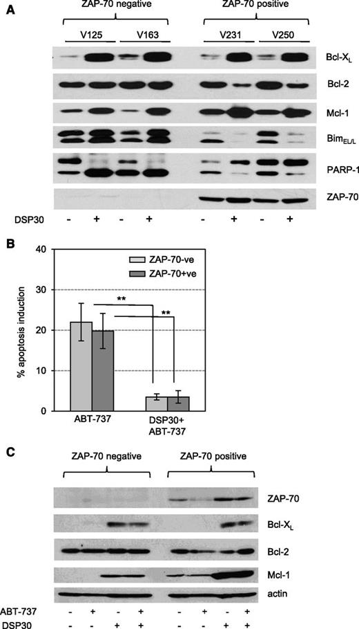 Figure 2. Bim downmodulation is associated with prosurvival responses to TLR9 stimulation. (A) Expression profile of BH3 proteins in CLL cells treated with or without DSP30 for 72 hours. Data show western blot analysis of n = 4 representative patients samples out of n = 10 tested. Samples were encrypted and anonymized by V numbers. (B) Percentage of ABT-737–induced apoptosis was calculated in relation to the respective untreated controls. CLL cells were precultured with or without DSP30 for 24 hours and subsequently treated with 5 nM ABT-737 for 24 hours. Viability was assessed by determining the percentages of annexin-V/PI–negative cells. Data are presented as the mean ± SD of n = 18 patient samples in a bar diagram. P values are indicated by asterisks: **P < .01. (C) Expression profile of antiapoptotic proteins in DSP30-treated CLL cells with or without ABT-737 treatment (5 nM) for 24 hours. Data show representative western blot analysis of n = 4 tested patients samples.