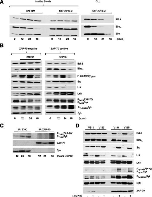 Figure 5. Syk, but not Src, activation by TLR9 signals is restricted to ZAP-70–positive cells. (A) BH3 proteins expressed in purified B cells from 1 tonsil or from CLL patients stimulated with anti-IgM or costimulated with DSP30/IL-2 for the time points as indicated. (B) Expression profile of BCR-related signaling molecules in ZAP-70–negative and ZAP-70–positive CLL cells stimulated with DSP30 over a time course of 48 hours. One out of 3 independent experiments are shown. (C) Syk or ZAP-70 was immunoprecipitated from DSP30-stimulated Zap-70–positive cells at the time points as indicated. Blots were probed with P-Tyr319/T352-ZAP-70/Syk antibody or with ZAP-70/Syk antibodies, respectively. (D) Expression profile of BCR-related signaling molecules in CLL cells treated with or without DSP30 for 48 hours. Data show western blot analysis of n = 4 representative patient samples out of n = 6 tested. Samples were encrypted and anonymized by V numbers.