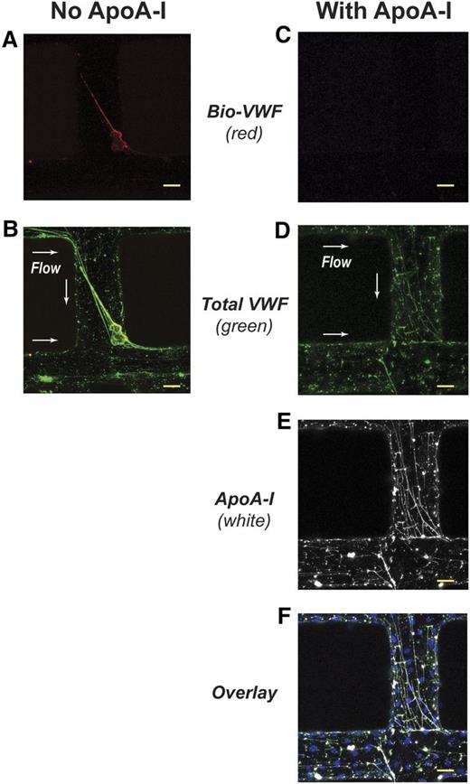 Figure 4. ApoA-I prevents the binding of fluid-phase Bio-VWF to VWF fibers in synthetic microvessels. The synthetic microvessels containing HUVECs were activated with 200 ng/mL of PMA for 40 minutes at 37°C and then washed with phosphate-buffered saline (PBS) containing 6% BSA for 5 minutes. ApoA-I (500 μg/mL in SFM) or SFM was perfused over the activated microvessels for 5 minutes followed by perfusion of Bio-VWF (10 μg/mL in SFM). At the end of the experiments, the microvessels were washed with PBS containing 6% BSA for 5 minutes before staining for VWF and ApoA-I. Vessels perfused with either buffer or ApoA-I were both stained with antibody to ApoA-I. There was no signal for ApoA-I in the vessels perfused with buffer (image not shown). Secreted VWF in the microvessels self-associated to form transluminal fibers. (A) In the absence of ApoA-I, Bio-VWF (red) perfused through the activated microvessel bound to a transluminal VWF fiber, accumulating on its upstream side. (B) Colocalization of Bio-VWF (yellow) with the transluminal VWF fiber (green). (C) Absence of Bio-VWF localization in a microvessel when ApoA-I was perfused through the vessel before Bio-VWF. (D) VWF fibers (green) secreted by the activated microvessels. (E) ApoA-I (white) localization in a microvessel after perfusion. (F) Colocalization of ApoA-I (white) with VWF fibers (green). Nuclei of HUVECs are in blue. Scale bars, 50 μm (A-F). Arrows indicate direction of flow.
