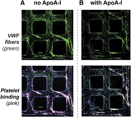 Figure 5. Platelet binding to VWF fibers in synthetic microvessels. HUVECs in synthetic microvessels were activated with 200 ng/mL PMA for 40 minutes at 37°C then washed with PBS containing 6% BSA for 5 minutes. Serum-free medium or ApoA-I (500 μg/mL) in serum-free medium was perfused over the activated microvessels for 5 minutes followed by perfusion of freshly prepared washed platelets (3 × 105 platelets per μL). (A) Without ApoA-I perfusion, washed platelets (pink) bound to VWF fibers (green) in microvessels. (B) With ApoA-I perfusion, fewer VWF fibers (green) accumulated in microvessels and fewer washed platelets (pink) bound the fibers. Scale bars, 100 μm (A-B).